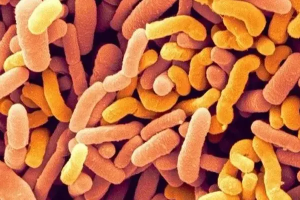 Streptococcus thermophilus